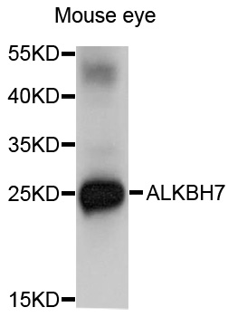 ALKBH7 Antibody - Western blot analysis of extracts of Mouse eye cells.