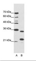 ALKBH8 Antibody - A: Marker, B: Jurkat Cell Lysate.  This image was taken for the unconjugated form of this product. Other forms have not been tested.