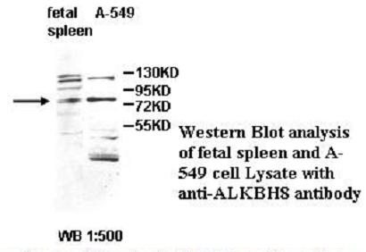 ALKBH8 Antibody