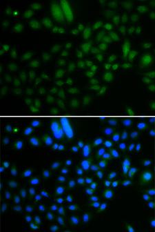 ALKBH8 Antibody - Immunofluorescence analysis of A549 cells.