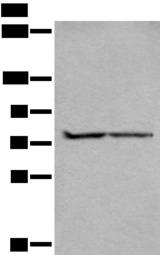 ALKBH8 Antibody - Western blot analysis of A549 and Jurkat cell lysates  using ALKBH8 Polyclonal Antibody at dilution of 1:300