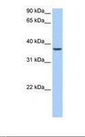 ALKBH8 Antibody - Liver cell lysate. Antibody concentration: 0.5 ug/ml. Gel concentration: 12%.  This image was taken for the unconjugated form of this product. Other forms have not been tested.