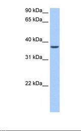 ALKBH8 Antibody - Liver cell lysate. Antibody concentration: 0.5 ug/ml. Gel concentration: 12%.  This image was taken for the unconjugated form of this product. Other forms have not been tested.