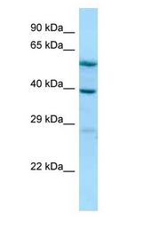 ALLC Antibody - ALLC antibody Western Blot of Jurkat.  This image was taken for the unconjugated form of this product. Other forms have not been tested.