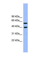 ALLC Antibody - ALLC antibody Western blot of Jurkat lysate. This image was taken for the unconjugated form of this product. Other forms have not been tested.