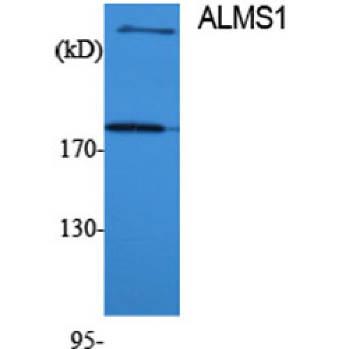 ALMS1 Antibody - Western blot of ALMS1 antibody