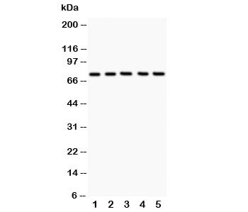 ALOX12 / 12 Lipoxygenase Antibody - Western blot testing of 12 Lipoxygenase antibody and Lane 1: A549; 2: MCF-7; 3: COLO320; 4: Jurkat; 5: HeLa; Predicted size: 75KD; Observed size: 75KD