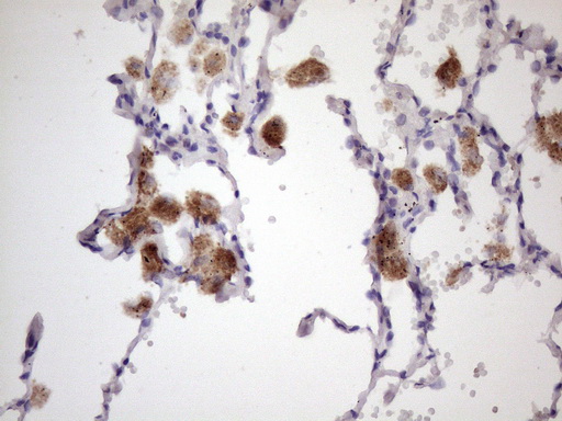 ALOX12 / 12 Lipoxygenase Antibody - Immunohistochemical staining of paraffin-embedded Human lung tissue within the normal limits using anti-ALOX12 mouse monoclonal antibody. (Heat-induced epitope retrieval by 1 mM EDTA in 10mM Tris, pH8.5, 120C for 3min. (1:150)