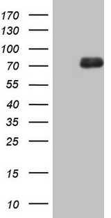 ALOX12 / 12 Lipoxygenase Antibody - HEK293T cells were transfected with the pCMV6-ENTRY control (Left lane) or pCMV6-ENTRY ALOX12 (Right lane) cDNA for 48 hrs and lysed. Equivalent amounts of cell lysates (5 ug per lane) were separated by SDS-PAGE and immunoblotted with anti-ALOX12 (1:2000).