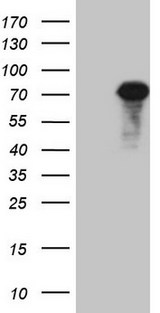 ALOX12 / 12 Lipoxygenase Antibody - HEK293T cells were transfected with the pCMV6-ENTRY control (Left lane) or pCMV6-ENTRY ALOX12 (Right lane) cDNA for 48 hrs and lysed. Equivalent amounts of cell lysates (5 ug per lane) were separated by SDS-PAGE and immunoblotted with anti-ALOX12.