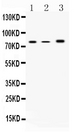 ALOX12 / 12 Lipoxygenase Antibody - Western blot - Anti-12 Lipoxygenase Picoband Antibody