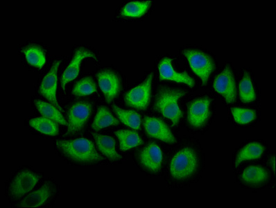 ALOX12 / 12 Lipoxygenase Antibody - Immunofluorescence staining of A549 cells diluted at 1:166, counter-stained with DAPI. The cells were fixed in 4% formaldehyde, permeabilized using 0.2% Triton X-100 and blocked in 10% normal Goat Serum. The cells were then incubated with the antibody overnight at 4°C.The Secondary antibody was Alexa Fluor 488-congugated AffiniPure Goat Anti-Rabbit IgG (H+L).