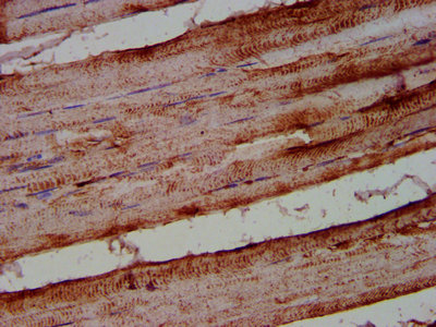 ALOX12 / 12 Lipoxygenase Antibody - Immunohistochemistry Dilution at 1:500 and staining in paraffin-embedded human skeletal muscle tissue performed on a Leica BondTM system. After dewaxing and hydration, antigen retrieval was mediated by high pressure in a citrate buffer (pH 6.0). Section was blocked with 10% normal Goat serum 30min at RT. Then primary antibody (1% BSA) was incubated at 4°C overnight. The primary is detected by a biotinylated Secondary antibody and visualized using an HRP conjugated SP system.