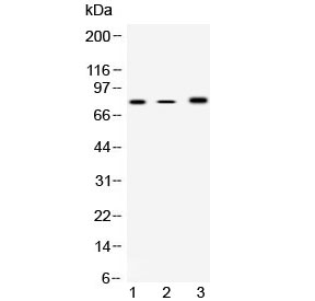 ALOX12 / 12 Lipoxygenase Antibody - Western blot testing of 1) rat spleen, 2) mouse spleen and 3) human COLO320 lysate with 12 Lipoxygenase antibody at 0.5ug/ml. Predicted molecular weight ~76 kDa.
