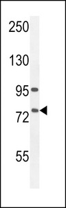 ALOX12B Antibody - ALOX12B Antibody western blot of A549 cell line lysates (35 ug/lane). The ALOX12B antibody detected the ALOX12B protein (arrow).
