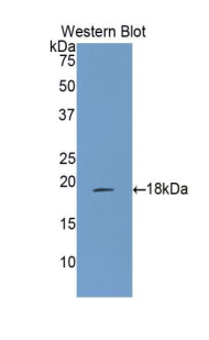 ALOX15 / 15-Lipoxygenase Antibody - Western blot of recombinant 15-LOX / ALOX15.  This image was taken for the unconjugated form of this product. Other forms have not been tested.