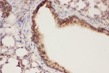 ALOX15 / 15-Lipoxygenase Antibody - ALOX15 antibody IHC-paraffin: Mouse Lung Tissue.
