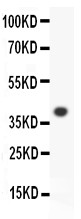 ALOX15 / 15-Lipoxygenase Antibody - ALOX15 antibody Western blot. All lanes: Anti-ALOX15 at 0.5 ug/m. WB: Recombinant Human ALOX15 Protein 0.5ng. Predicted band size: 39 kD. Observed band size: 39 kD.