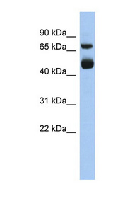 ALOX15 / 15-Lipoxygenase Antibody - ALOX15 / 15 Lipoxygenase 1 antibody Western blot of Fetal Heart lysate. This image was taken for the unconjugated form of this product. Other forms have not been tested.