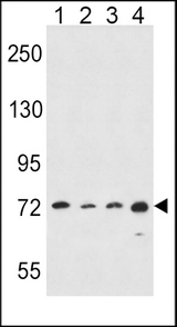 ALOX15 / 15-Lipoxygenase Antibody - ALOX15 Antibody western blot of HeLa(lane 1),A549(lane 2),K562(lane 3),MDA-MB435(lane 4) cell line lysates (35 ug/lane). The ALOX15 antibody detected the ALOX15 protein (arrow).