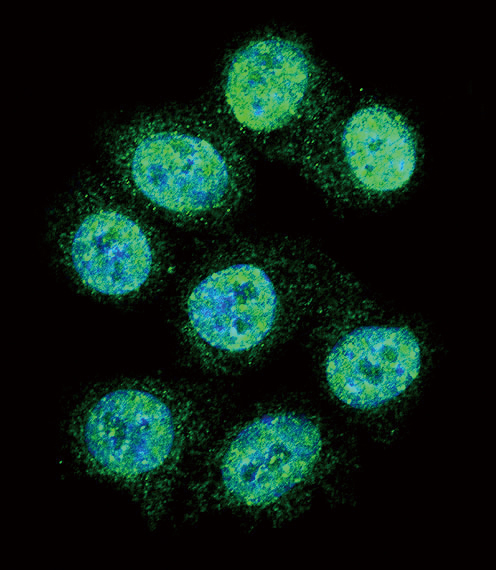 ALOX15 / 15-Lipoxygenase Antibody - Confocal immunofluorescence of ALOX15 Antibody with HeLa cell followed by Alexa Fluor 488-conjugated goat anti-rabbit lgG (green). DAPI was used to stain the cell nuclear (blue).
