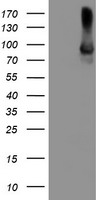 ALOX15 / 15-Lipoxygenase Antibody - HEK293T cells were transfected with the pCMV6-ENTRY control (Left lane) or pCMV6-ENTRY ALOX15 (Right lane) cDNA for 48 hrs and lysed. Equivalent amounts of cell lysates (5 ug per lane) were separated by SDS-PAGE and immunoblotted with anti-ALOX15.