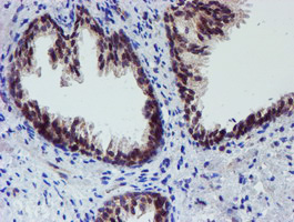 ALOX15 / 15-Lipoxygenase Antibody - IHC of paraffin-embedded Human prostate tissue using anti-ALOX15 mouse monoclonal antibody.