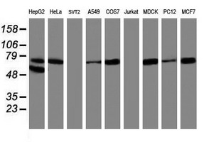 ALOX15 / 15-Lipoxygenase Antibody - Western blot of extracts (35 ug) from 9 different cell lines by using anti-ALOX15 monoclonal antibody.