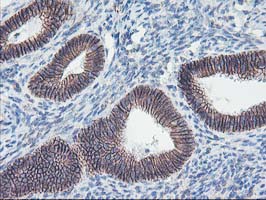 ALOX15 / 15-Lipoxygenase Antibody - IHC of paraffin-embedded Human endometrium tissue using anti-ALOX15 mouse monoclonal antibody.