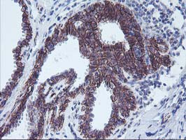 ALOX15 / 15-Lipoxygenase Antibody - IHC of paraffin-embedded Human breast tissue using anti-ALOX15 mouse monoclonal antibody.