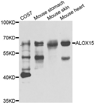 ALOX15 / 15-Lipoxygenase Antibody - Western blot analysis of extracts of various cell lines.