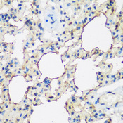 ALOX15 / 15-Lipoxygenase Antibody - Immunohistochemistry of paraffin-embedded rat lung tissue.