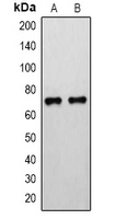 ALOX15 / 15-Lipoxygenase Antibody