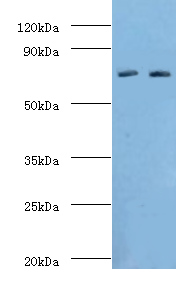 ALOX15B / 15-LOX-2 Antibody - Western blot. All lanes: Arachidonate 15-lipoxygenase B antibody at 11 ug/ml. Lane 1: MCF-7 whole cell lysate. Lane 2: 293T whole cell lysate. Secondary antibody: Goat polyclonal to rabbit at 1:10000 dilution. Predicted band size: 76 kDa. Observed band size: 76 kDa Immunohistochemistry.