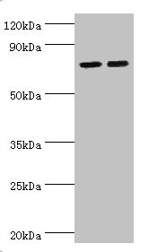 ALOX15B / 15-LOX-2 Antibody - Western blot All lanes: Arachidonate 15-lipoxygenase B antibody at 11µg/ml Lane 1: MCF-7 whole cell lysate Lane 2: 293T whole cell lysate Secondary Goat polyclonal to rabbit IgG at 1/10000 dilution Predicted band size: 76, 68, 70, 73 kDa Observed band size: 76 kDa