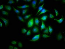 ALOX15B / 15-LOX-2 Antibody - Immunofluorescence staining of A549 cells with ALOX15B Antibody at 1:166, counter-stained with DAPI. The cells were fixed in 4% formaldehyde, permeabilized using 0.2% Triton X-100 and blocked in 10% normal Goat Serum. The cells were then incubated with the antibody overnight at 4°C. The secondary antibody was Alexa Fluor 488-congugated AffiniPure Goat Anti-Rabbit IgG(H+L).