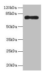 ALOX15B / 15-LOX-2 Antibody - Western blot All lanes: Arachidonate 15-lipoxygenase B antibody at 16µg/ml + HepG2 whole cell lysate Secondary Goat polyclonal to rabbit IgG at 1/10000 dilution Predicted band size: 76, 68, 70, 73 kDa Observed band size: 76 kDa