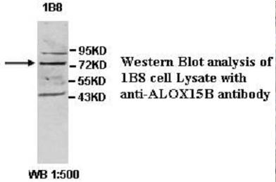 ALOX15B / 15-LOX-2 Antibody