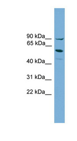ALOX15B / 15-LOX-2 Antibody - ALOX15B / 15 Lipoxygenase 2 antibody Western blot of HepG2 cell lysate. This image was taken for the unconjugated form of this product. Other forms have not been tested.