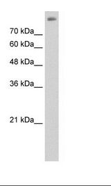 ALOX15B / 15-LOX-2 Antibody - Jurkat Cell Lysate.  This image was taken for the unconjugated form of this product. Other forms have not been tested.