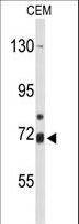 ALOX15B / 15-LOX-2 Antibody - Western blot of ALOX15B Antibody in CEM cell line lysates (35 ug/lane). ALOX15B (arrow) was detected using the purified antibody.