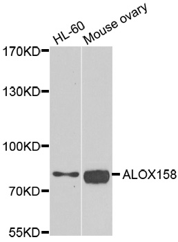ALOX15B / 15-LOX-2 Antibody - Western blot analysis of extracts of various cell lines.
