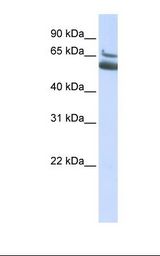 ALOX15B / 15-LOX-2 Antibody - HepG2 cell lysate. Antibody concentration: 1.0 ug/ml. Gel concentration: 12%.  This image was taken for the unconjugated form of this product. Other forms have not been tested.