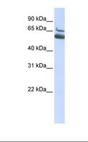 ALOX15B / 15-LOX-2 Antibody - HepG2 cell lysate. Antibody concentration: 1.0 ug/ml. Gel concentration: 12%.  This image was taken for the unconjugated form of this product. Other forms have not been tested.