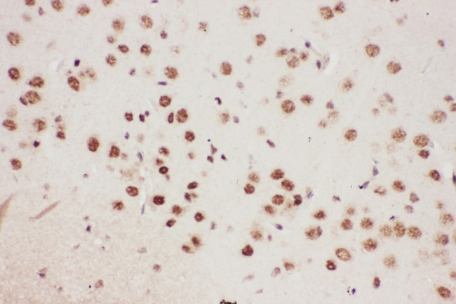 ALOX5 / 5-LOX Antibody - ALOX5 antibody IHC-paraffin: Mouse Brain Tissue.