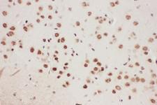 ALOX5 / 5-LOX Antibody - ALOX5 antibody IHC-paraffin: Mouse Brain Tissue.
