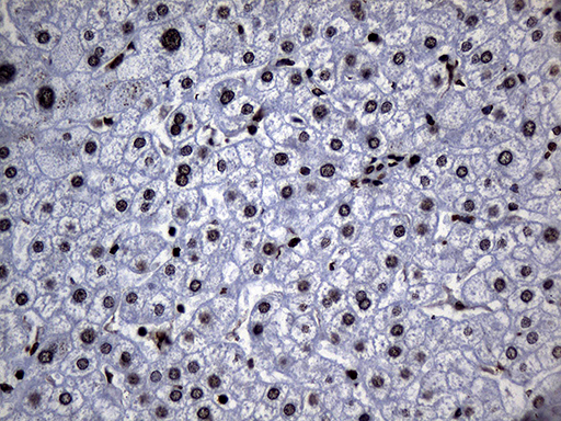 ALOX5 / 5-LOX Antibody - Immunohistochemical staining of paraffin-embedded Human liver tissue within the normal limits using anti-ALOX5 mouse monoclonal antibody. (Heat-induced epitope retrieval by 1mM EDTA in 10mM Tris buffer. (pH8.5) at 120°C for 3 min. (1:500)