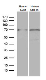 ALOX5 / 5-LOX Antibody - Western blot analysis of extracts. (35ug) from 2 different tissue lysates by using anti-ALOX5 monoclonal antibody. (1:500)