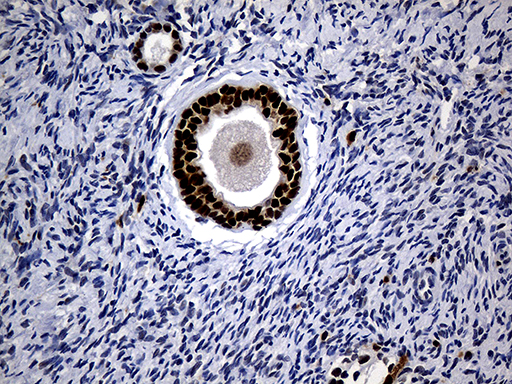 ALOX5 / 5-LOX Antibody - Immunohistochemical staining of paraffin-embedded Human Ovary tissue within the normal limits using anti-ALOX5 mouse monoclonal antibody. (Heat-induced epitope retrieval by 1mM EDTA in 10mM Tris buffer. (pH8.5) at 120°C for 3 min. (1:2000)