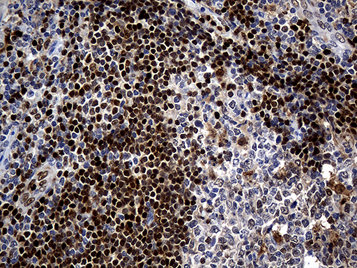 ALOX5 / 5-LOX Antibody - Immunohistochemical staining of paraffin-embedded Human appendix tissue within the normal limits using anti-ALOX5 mouse monoclonal antibody. (Heat-induced epitope retrieval by Tris-EDTA(1:2000)